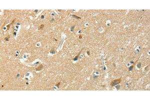 Immunohistochemistry of paraffin-embedded Human brain using ASAH2 Polyclonal Antibody at dilution of 1:50 (ASAH2 antibody)