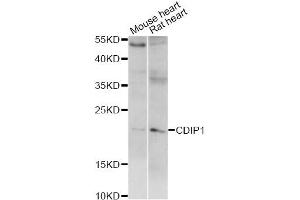 Western blot analysis of extracts of various cell lines, using CDIP1 antibody (ABIN6293220) at 1:1000 dilution.