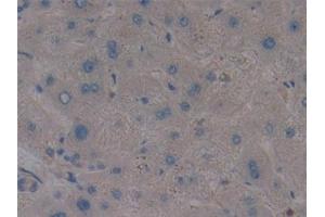 Detection of AMPK Alpha 1 in Human Liver Tissue using Polyclonal Antibody to Protein Kinase, AMP Activated Alpha 1 (AMPK Alpha 1) (PRKAA1 antibody  (AA 28-257))