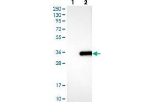 Western blot analysis of Lane 1: Negative control (vector only transfected HEK293T lysate), Lane 2: Over-expression Lysate (Co-expressed with a C-terminal myc-DDK tag (~3. (APIP antibody)