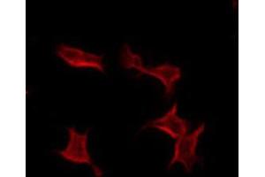 ABIN6274339 staining COLO205 by IF/ICC. (TUSC3 antibody  (Internal Region))