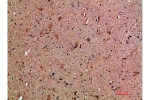 Immunohistochemical analysis of paraffin-embedded human-brain, antibody was diluted at 1:200 (CLCF1 antibody  (AA 171-220))