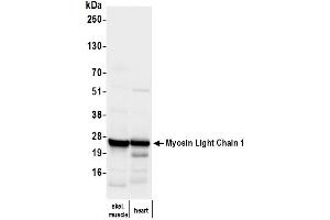 Western Blotting (WB) image for anti-Myosin, Light Chain 1, Alkali, Skeletal, Fast (MYL1) (Light Chain) antibody (ABIN7795615)