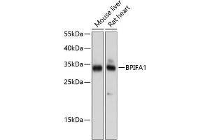 Western blot analysis of extracts of various cell lines, using BPIF antibody (ABIN6132500, ABIN6137634, ABIN6137635 and ABIN6224733) at 1:1000 dilution. (BPIFA1 antibody  (AA 20-256))