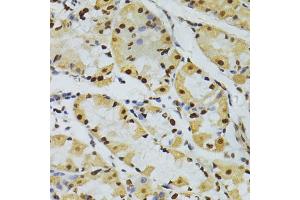Immunohistochemistry of paraffin-embedded human stomach using ALYREF antibody (ABIN5973579) at dilution of 1/100 (40x lens). (THO Complex 4 antibody)