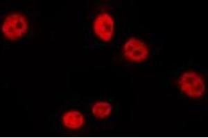 ABIN6275738 staining HepG2 by IF/ICC. (Arx antibody  (Internal Region))