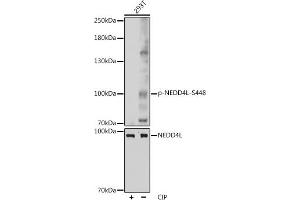 Western blot analysis of extracts of 293T cells, using Phospho-NEDD4L-S448 pAb (ABIN7266883) at 1:1000 dilution or NEDD4L antibody (ABIN6132407, ABIN6144504, ABIN6144505 and ABIN6224109). (NEDD4-2 antibody  (pSer448))