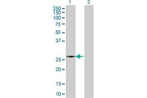 Western Blot analysis of F8 expression in transfected 293T cell line by F8 MaxPab polyclonal antibody. (Factor VIII antibody  (AA 1-216))