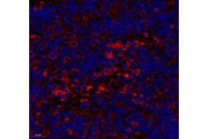 Immunofluorescence of paraffin embedded rat lymph node using CD163b (ABIN7073371) at dilution of 1: 700 (450x lens) (CD163L1 antibody)