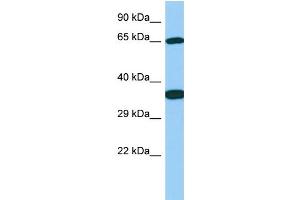 Host: Rabbit Target Name: Galnt13 Sample Type: Rat Stomach lysates Antibody Dilution: 1. (GALNT13 antibody  (C-Term))