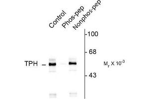 Image no. 1 for anti-Tryptophan Hydroxylase 1 (TPH1) (pSer260) antibody (ABIN372733) (Tryptophan Hydroxylase 1 antibody  (pSer260))