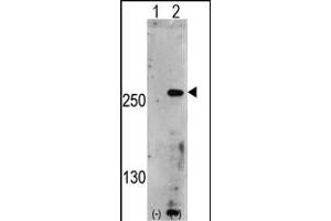 Western blot analysis of PIP5K3 (arrow) using rabbit polyclonal PIP5K3 Antibody (Center) (ABIN391254 and ABIN2841314). (PIKFYVE antibody  (AA 1531-1561))