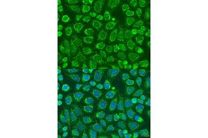 Immunofluorescence analysis of U2OS cells using SNX32 antibody (ABIN6133108, ABIN6148251, ABIN6148252 and ABIN6224028) at dilution of 1:100. (SNX32 antibody  (AA 144-403))