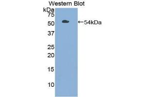 Western blot analysis of the recombinant protein. (TLR3 antibody  (AA 727-905))