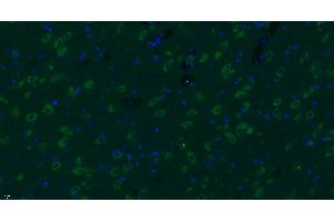 Paraformaldehyde-fixed, paraffin embedded rat brain, Antigen retrieval by boiling in sodium citrate buffer (pH6) for 15min, Block endogenous peroxidase by 3% hydrogen peroxide for 30 minutes, Blocking buffer (normal goat serum) at 37°C for 20min, Antibody incubation with Progestin Receptor Beta/MPRB Antibody  at 1:400 overnight at 4°C, followed by a conjugated secondary Goat Anti-Rabbit IgG antibody -FITC) for 90 minutes, and DAPI for nuclei staining. (Progestin Receptor beta/mprb (AA 251-300) antibody)