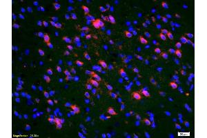 Formalin-fixed and paraffin-embedded rat brain labeled with Anti-Deltex 1 Polyclonal Antibody, Unconjugated (ABIN668125) 1:200, overnight at 4°C, The secondary antibody was Goat Anti-Rabbit IgG, Cy3 conjugated used at 1:200 dilution for 40 minutes at 37°C. (Deltex Homolog 1 antibody  (AA 351-450))