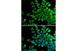 Immunofluorescence analysis of HeLa cells using BAD antibody (ABIN5970771). (BAD antibody)