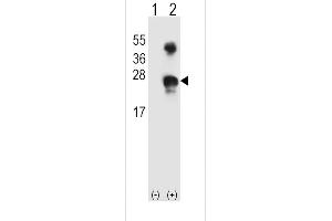 Western blot analysis of GADD45A (arrow) using rabbit polyclonal GADD45A Antibody (N-term) (ABIN389281 and ABIN2839407). (GADD45A antibody  (N-Term))