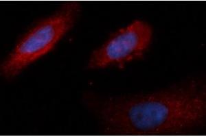 Immunofluorescence (IF) image for anti-Lactate Dehydrogenase B (LDHB) (AA 1-334) antibody (PE) (ABIN5565786) (LDHB antibody  (AA 1-334) (PE))