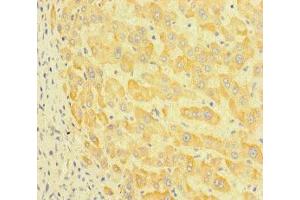 Immunohistochemistry of paraffin-embedded human liver tissue using ABIN7164777 at dilution of 1:100 (LEPREL1 antibody  (AA 301-528))