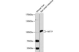 Western blot analysis of extracts of various cell lines, using MTTP antibody (ABIN3022483, ABIN3022484, ABIN3022485 and ABIN6218847) at 1:1000 dilution.