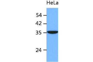 The cell lysates of HeLa (40ug) were resolved by SDS-PAGE, transferred to PVDF membrane and probed with anti-human ING2 antibody (1:1000). (ING2 antibody)