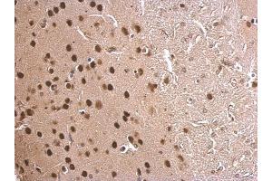 IHC-P Image MEF2C antibody detects MEF2C protein at nucleus on mouse fore brain by immunohistochemical analysis.