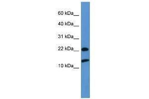 WB Suggested Anti-RPS27A Antibody Titration: 0. (RPS27A antibody  (Middle Region))