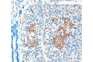 ABIN185410 (1µg/ml) staining of paraffin embedded Human Pancreas shows staining of cytoplasm in some cells of the islets of Langerhans. (LRP5 antibody  (Internal Region))