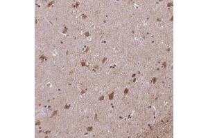 Immunohistochemical staining (Formalin-fixed paraffin-embedded sections) of human lateral ventricle with ARPP-21 polyclonal antibody  shows moderate cytoplasmic and nuclear positivity in neuronal cells.