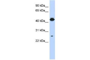 WB Suggested Anti-PDIK1L Antibody Titration: 0. (PDIK1L antibody  (Middle Region))
