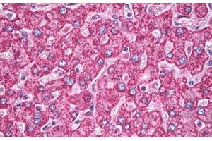 Image no. 3 for anti-Superoxide Dismutase 2, Mitochondrial (SOD2) antibody (ABIN1496289) (SOD2 antibody)