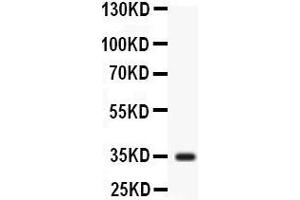 Observed bind size: 35KD (Liver Arginase antibody  (N-Term))
