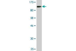 Western Blot detection against Immunogen (85. (CHEK2 antibody  (AA 1-543))