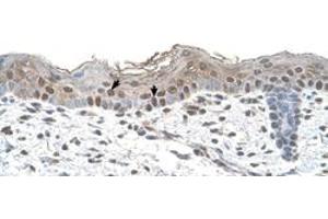 Immunohistochemical staining (Formalin-fixed paraffin-embedded sections) of human skin with ARRB2 polyclonal antibody  at 4-8 ug/mL working concentration. (Arrestin 3 antibody  (Internal Region))