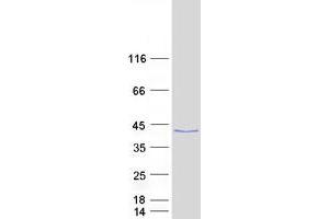 Kelch Domain Containing 9 (KLHDC9) (Transcript Variant 1) protein (Myc-DYKDDDDK Tag)