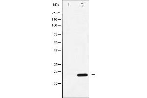 Western blot analysis of CPI17 alpha phosphorylation expression in RAW264. (CPI-17 antibody  (pThr38))