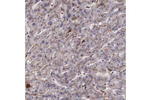 Immunohistochemical staining of human liver with APOH polyclonal antibody  shows moderate cytoplasmic positivity, with a granular pattern, in hepatocytes.