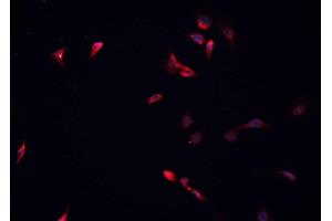 ABIN6266881 staining HeLa cells by IF/ICC. (HDAC5 antibody  (C-Term))