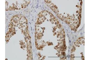 Image no. 4 for anti-DEAD (Asp-Glu-Ala-Asp) Box Polypeptide 6 (DDX6) (AA 1-484) antibody (ABIN598641) (DDX6 antibody  (AA 1-484))