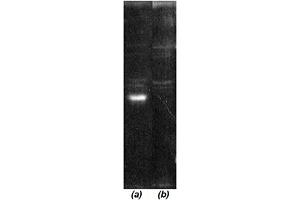 Western blot analysis: Luminograph of a HeLa S3 cytosol preparation after SDS PAGE followed by blotting onto PVDF membrane and probing with (a) antibody  and (b) antibody  pre-absorbed with cognate peptide. (COP9 Signalosome Csn6 Subunit (AA 283-297) antibody)