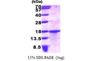 SDS-PAGE (SDS) image for Growth Differentiation Factor 15 (GDF15) (AA 195-308) protein (His tag) (ABIN666670) (GDF15 Protein (AA 195-308) (His tag))