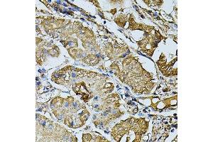 Immunohistochemistry of paraffin-embedded human stomach using CDH6 antibody. (CDH6 antibody  (AA 1-250))