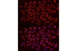 Immunofluorescence analysis of A-549 using EIF4B antibody (ABIN6127837, ABIN6140078, ABIN6140080 and ABIN6217245) at dilution of 1:25 (40x lens). (EIF4B antibody  (AA 352-611))