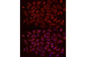 Immunofluorescence analysis of A-549 using EIF4B antibody (ABIN6127837, ABIN6140078, ABIN6140080 and ABIN6217245) at dilution of 1:25 (40x lens).