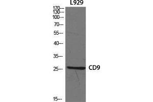 Western Blot (WB) analysis of specific cells using CD9 Polyclonal Antibody.