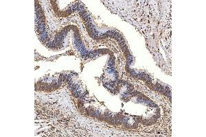 IHC analysis of Syntenin 2/SDCBP2 using anti-Syntenin 2/SDCBP2 antibody (ABIN7600017). (SDCBP2 antibody  (AA 14-292))