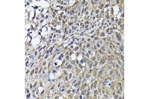 Immunohistochemistry of paraffin-embedded rat kidney using Phospho-Smad3-S423/S425 Rabbit mAb (ABIN6135336, ABIN6136288, ABIN6136289 and ABIN7101886) at dilution of 1:50 (40x lens). (SMAD3 antibody  (pSer423, pSer425))