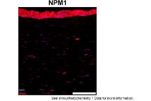 Sample Type: human cornea (frozen)Blue: DAPIRed: NPM1Primary Dilution: 1:100Image Submitted By: Geraint ParfittGavin Herbert Eye Institute . (NPM1 antibody  (N-Term))
