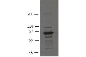 Image no. 1 for anti-Plakophilin 3 (PKP3) (AA 1-308) antibody (ABIN1169701) (Plakophilin 3 antibody  (AA 1-308))